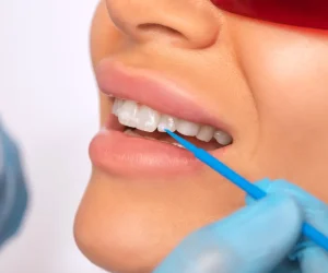 Can-You-Fully-Remineralize-Teeth