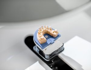scanning-jaw-model-on-the-3rd-scanner-2023-11-27-05-31-31-utc (1)
